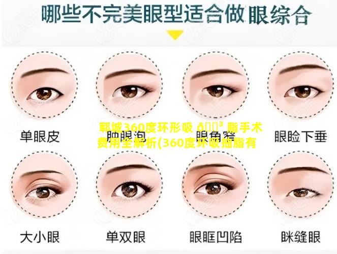 郓城360度环形吸 🐳 脂手术费用全解析(360度环吸抽脂有什么风 🐬 险)